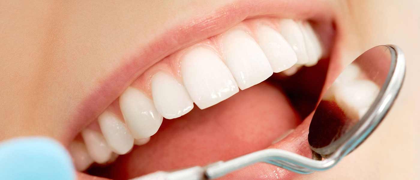Estética dental en Valladolid