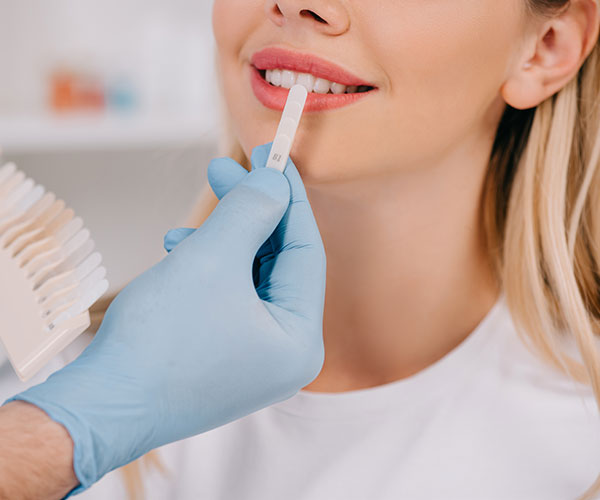 Blanqueamiento dientes en Valladolid