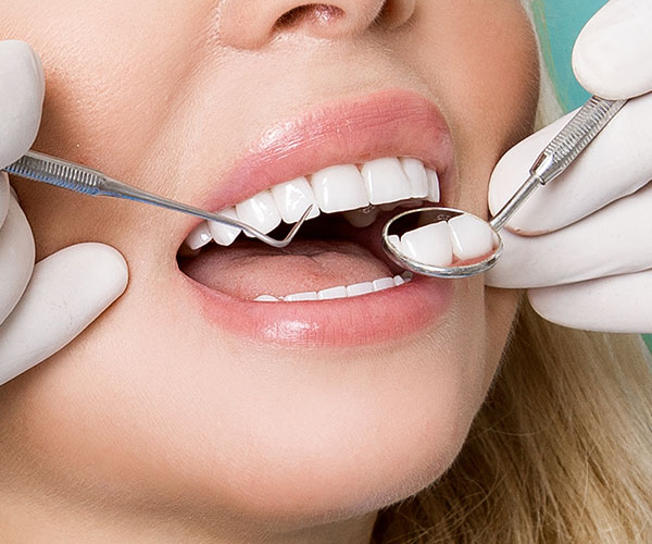 Corona dental en Valladolid