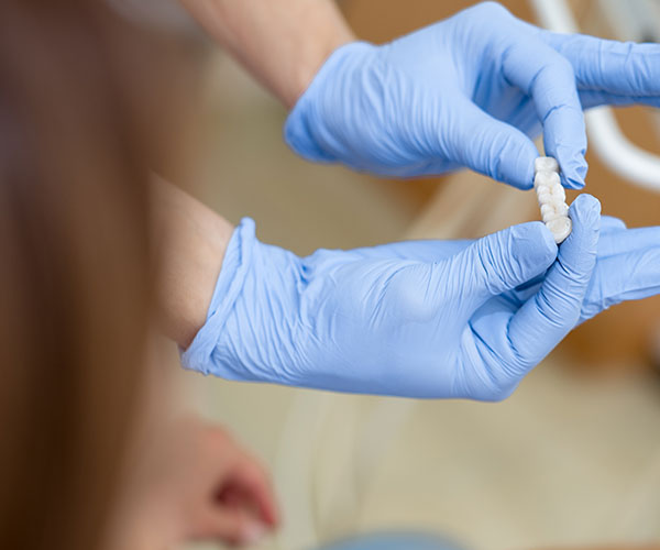 Puente dental en Valladolid